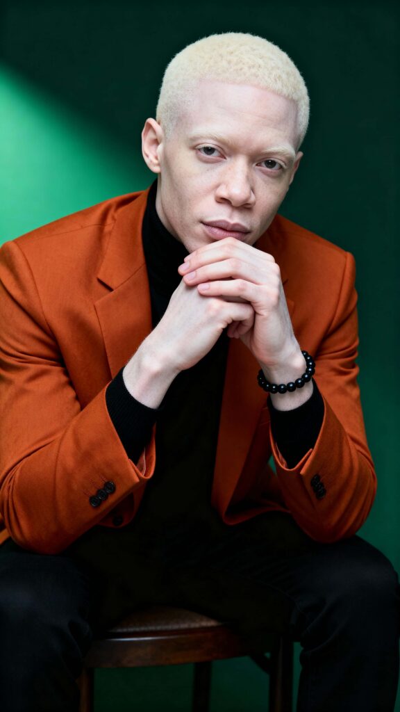Nigerian man with albinism portrait - Пример 1